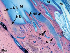 Image of OSSIX™ Volumax that shows mineralization progressing in to ossification at 3 months